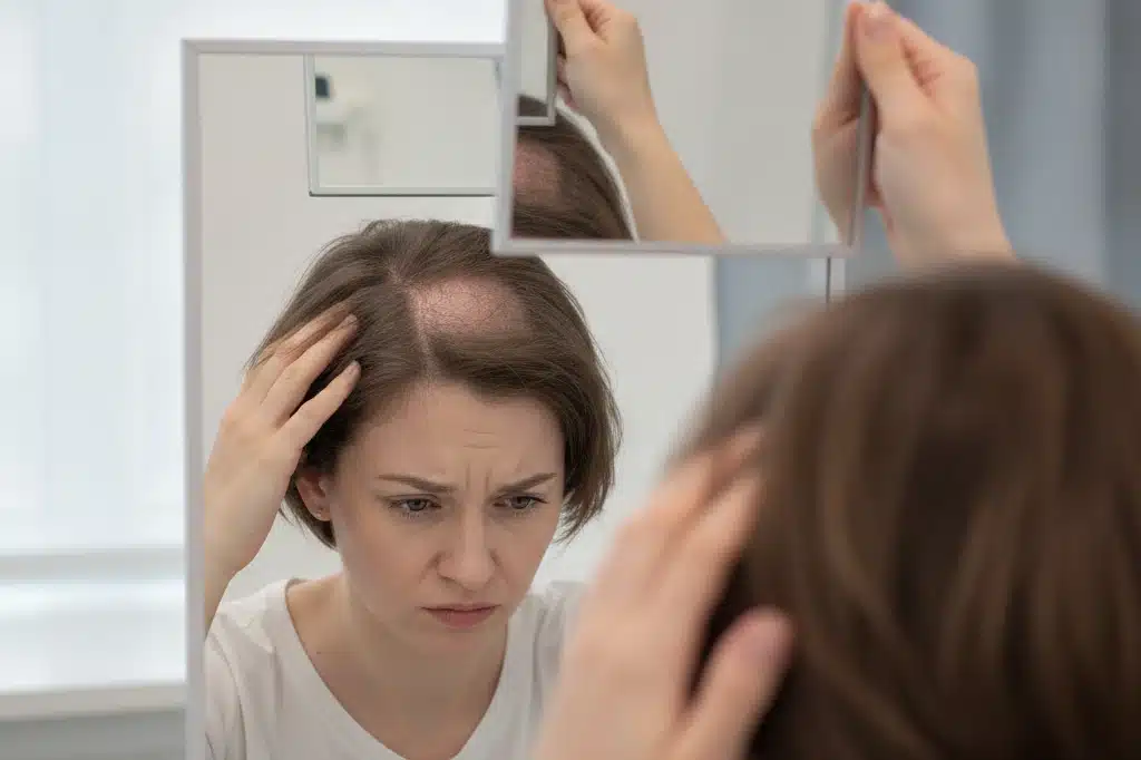Os principais sinais de queda de cabelo que você não deve ignorar